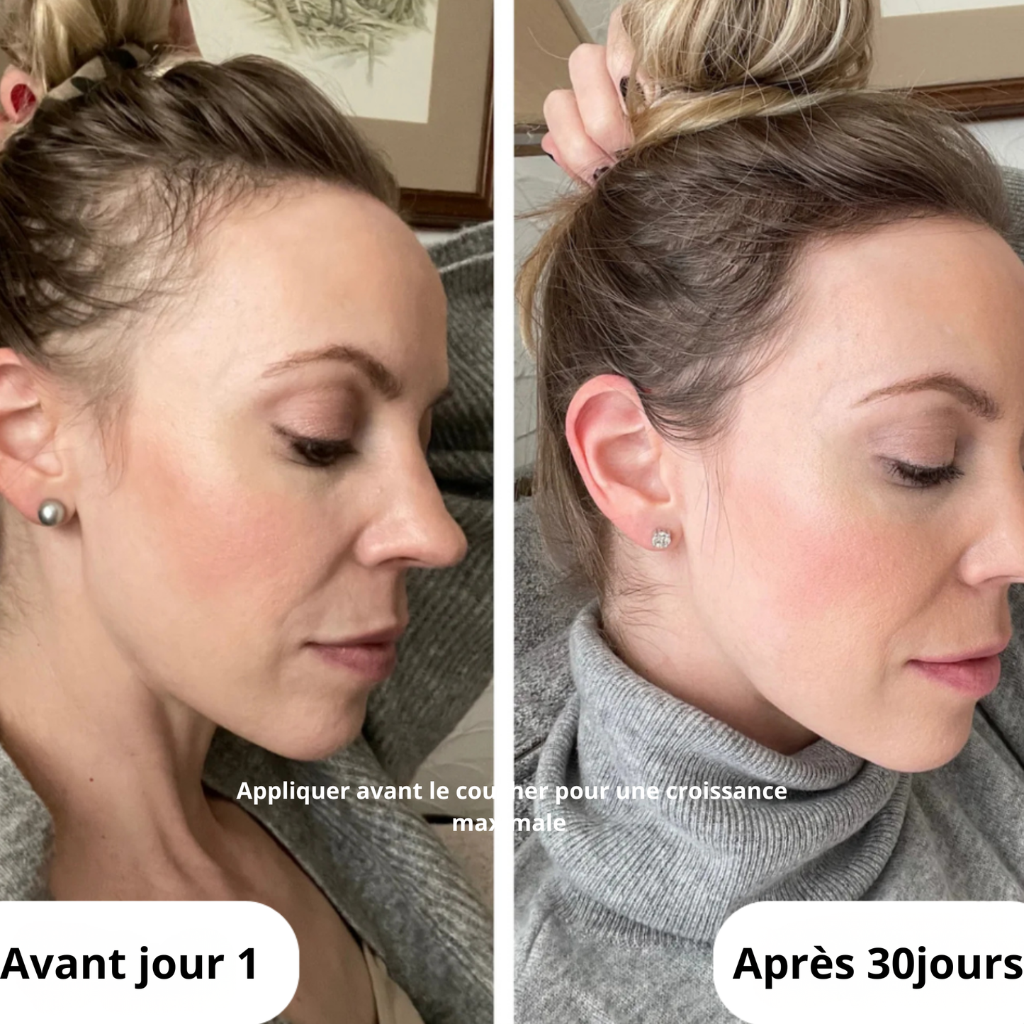 Celesta™ Roll on HairCare