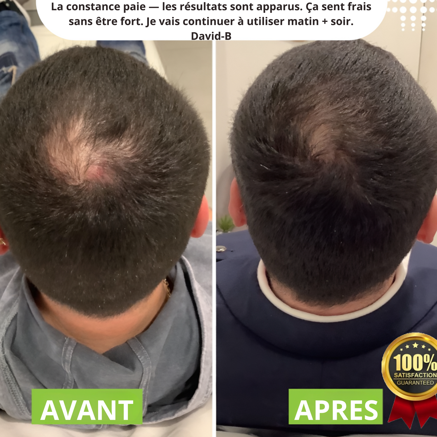 Celesta™ Roll on HairCare